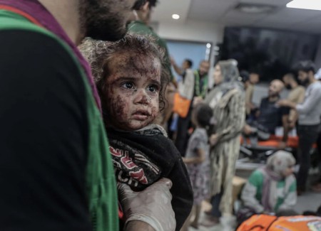 Gli occhi di Gaza: un bambino ferito, simbolo innocente della sofferenza civile in tempo di guerra